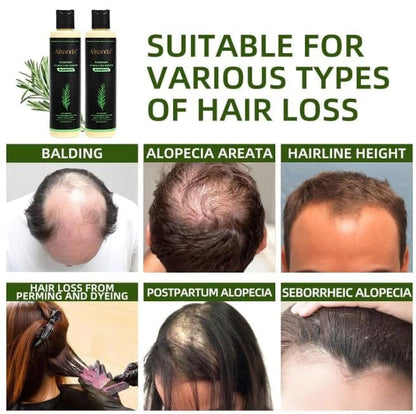 🎅Alisanda® Organic Rosemary Hair Growth Shampoo