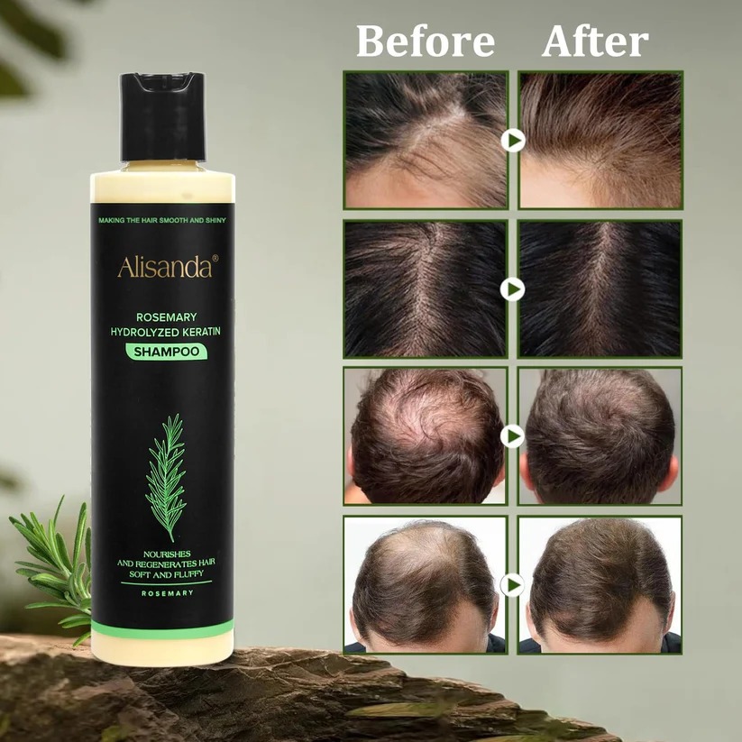 Alisanda® Organic Rosemary Hair Growth Shampoo