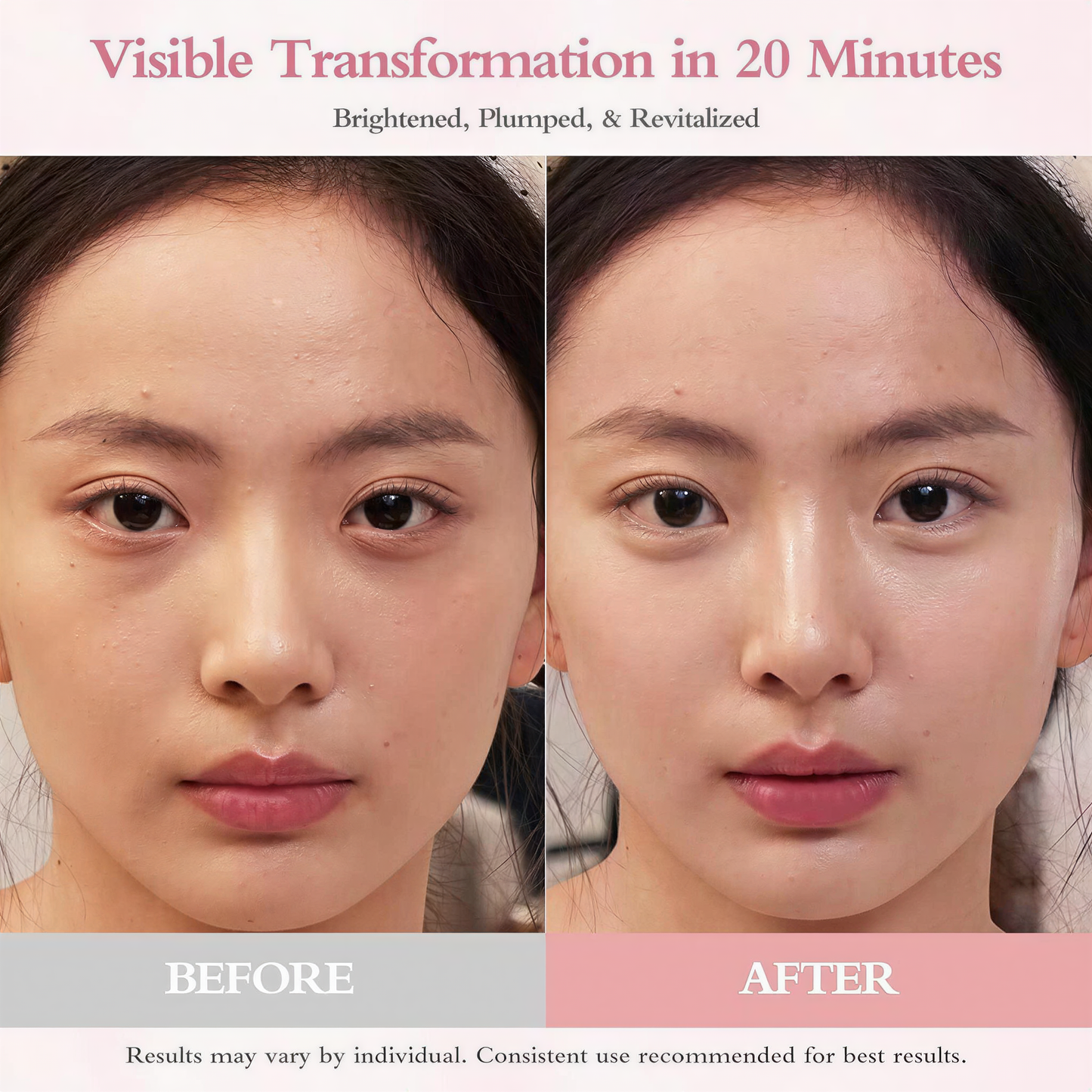 PDRN Eye Patch 5000ppm, Salmon DNA & Retinyl Eye Gel Mask, suitable for eye bags, dark circles, and wrinkles, 👍 the best gift for mom, 60 pieces
