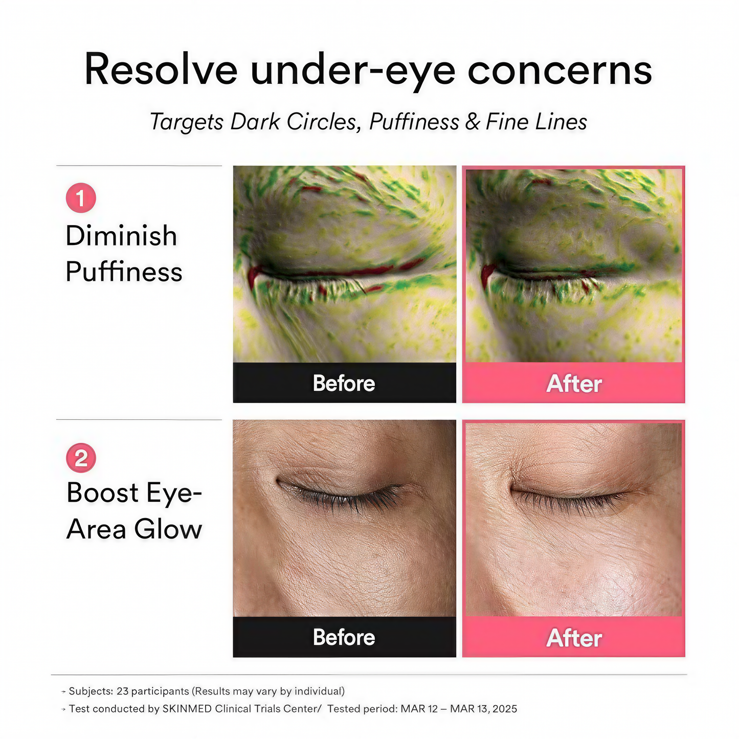 PDRN Eye Patch 5000ppm, Salmon DNA & Retinyl Eye Gel Mask, suitable for eye bags, dark circles, and wrinkles, 👍 the best gift for mom, 60 pieces