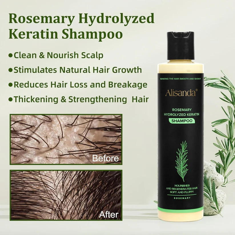 🔥LAST DAY 30% OFF -🔥Alisanda® Organic Rosemary Hair Growth Shampoo